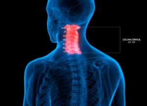 Dor Cervical - Tratamento em Brasília - Força Fisioterapia